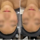 온약국 | 길음동 피부관리, 물광관리: 올가드림뷰티