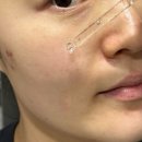 (주)아루 | 아루땅 스킨케어세트 토너 앰플 시카크림 3종 후기