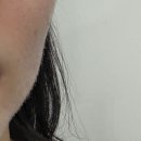오바코힐링뷰티샵 | 평택 피부관리 추천 | 슈크림힐링뷰티샵에서 맞춤 피부관리 받고 온 후기