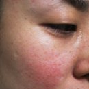 피부미인 - 연천군 | 피부미인