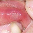 조선반점 이미지