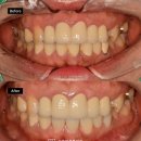 훈 기공소 이미지