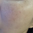 엑셀브이의원 이미지