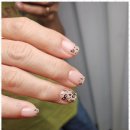 옐로우케어 이미지