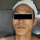 손앤손 에스테틱 | 방배동 피부관리 / 퍼스널 스킨케어 before & after