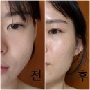 웰스피부과 | 피부관리실 부럽지 않은 뉴스킨 루미스파 / 웰스파 체험 후기