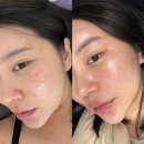 미플러스 | 인천 에스테틱 추천 학익동 미플러스 맞춤관리 솔직후기