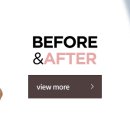 옐로우성형외과의원 이미지