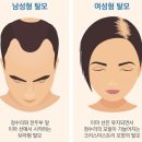 제경헤어샵 | #임산부탈모케어