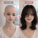 모앤미가발 | 시흥가발 검색하다 찾은 모앤미, 30대 항암가발 상담 후기