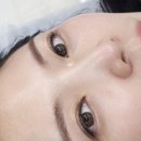 글루테라피