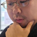 송용수 | 레이저 제모 하기