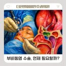 시원한이비인후과의원 | 송파 부비동염, 언제 수술이 필요한가요?