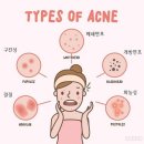 서울화봄의원 네이버블로그