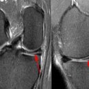 코끼리정형외과의원 이미지