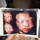 스테이바미 | 임신 28주차에서 29주차 일상, 만삭촬영, 입체초음파, 제미나이 아기 사진, 아기방 꾸미기, 제왕절개...