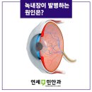 연세민안과의원 이미지