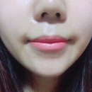 엔비테라피 행복점 | 행복한 생일파티 생일선물인증