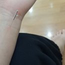 작전경희한의원 네이버블로그