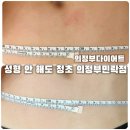 청초로 | [의정부다이어트] 퀸즈뷰티 뱃살케어 (성형 안 해도 청초) 뱃살관리 후기💛