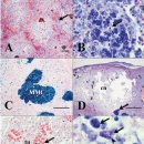 Lactococcus formosensis 침지 또는 주사 인위 감염 방어의 병리조직학적 변화 이미지