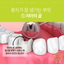 오치부식