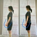 온 메디칼 | 대구 체형교정 거북목 라운드 숄더 승모근 통증 [하노버 메디칼 운동센터&amp;재활 PT]