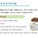 코피날때 응급처치 이미지