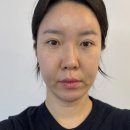 서면스킨플래닝 피부결 개선 제대로! 블링미뷰티에스테틱 서면피부관리 후기