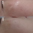 영등제일4차@경로당 | [올가드림뷰티/영등동] 풍성한 비누거품 마사지로 모공 디톡스, 모공 관리