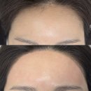 모나리자 | 일산 왁싱::마두역 헤어라인+이마 왁싱 솔직후기<모나리자눈썹왁싱>