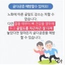 골밀도 높이는 방법 이미지