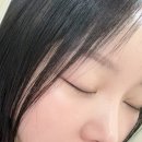 삼성역피부과 스킨보톡스 더모톡신 하이쿡스 통증 후기