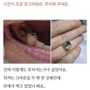 이수치과의원 | 이수역 치과 추천 야간진료 치과 크라운 ,인레이 가격 및 후기