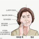 지창빌딩 | 익산 구안와사 한의원, 15년 경력 원장이 밝히는 치료 성공의 핵심.