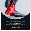 나은내일신경외과의원 | 발목 골절 재활기간? 얼마나 걸리는 지는 중요하지 않습니다