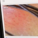 미금프라자약국 | 성남시 | 분당 미용실 메이원헤어, 두피 클리닉 후기