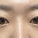 뷰티앤영의원 이미지