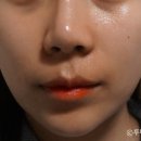 (주)메디타임 | 바르는 보톡스 메디타임네오 보탈리늄 앰플 사용후기
