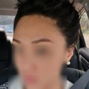 야탑로65번길 | 성공적인 성남 야탑 눈썹 잔흔제거 후기 - 리니끄브로우