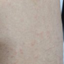 오피부과의원 이미지