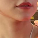 바른정약국 | 홍대피부과추천 입술필러 0.5cc 받고 온 후기 / 입술필러 전후 차이 비교 / 자연스러운 입술 완성