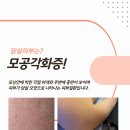 성균관한의원 | 수원모공각화증 결이 달라지는 순간