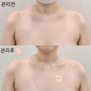 안현로서8길 | 평택 안중 근막관리 라운드숄더 교정 지니에스테틱 후기