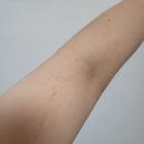 양지병원 건강검진 후기 (국가건강검진, 종합검진)