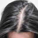 스칼프디자인센터 홍대점 이미지