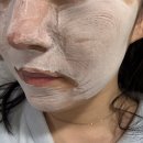 황금피부과의원 | 피부과 로션 블루씨피알 크림 팩클렌저 후기