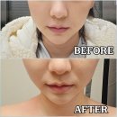 스킨앤바디 | 파주 운정피부관리 원스킨앤바디 윤곽관리 후기