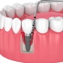 울산치과의원 이미지