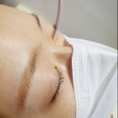 피부애휴일 네이버블로그